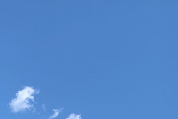 没有耳廓的耳朵：解析无耳廓的耳朵的原因美学