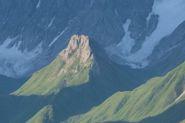 我接受了一次降颧骨手术提升面部轮廓